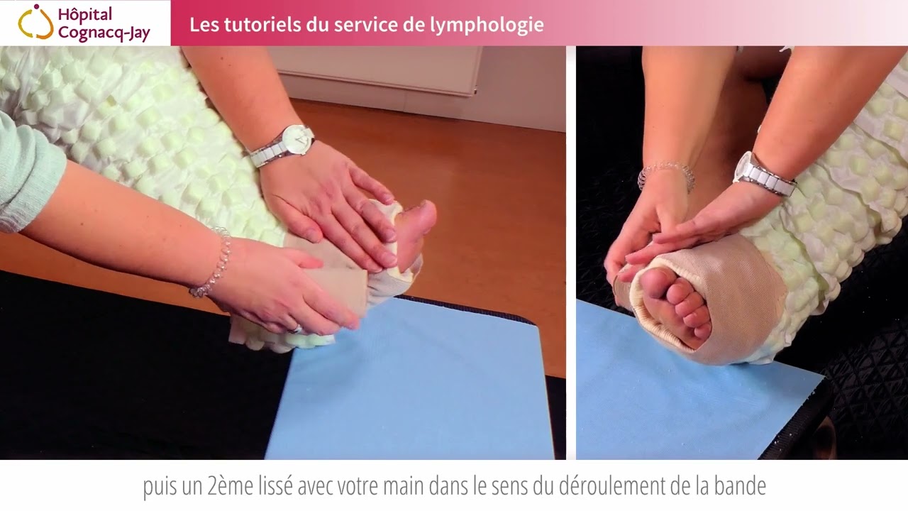Tutoriel à destination des patients - L'auto bandage du membre inférieur