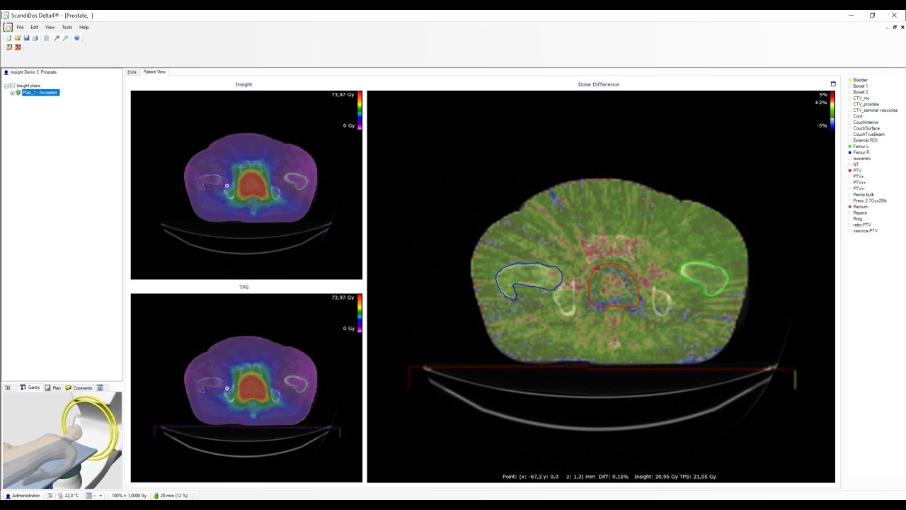 Automated verification of your TPS plan with new independent Monte Carlo algorithm