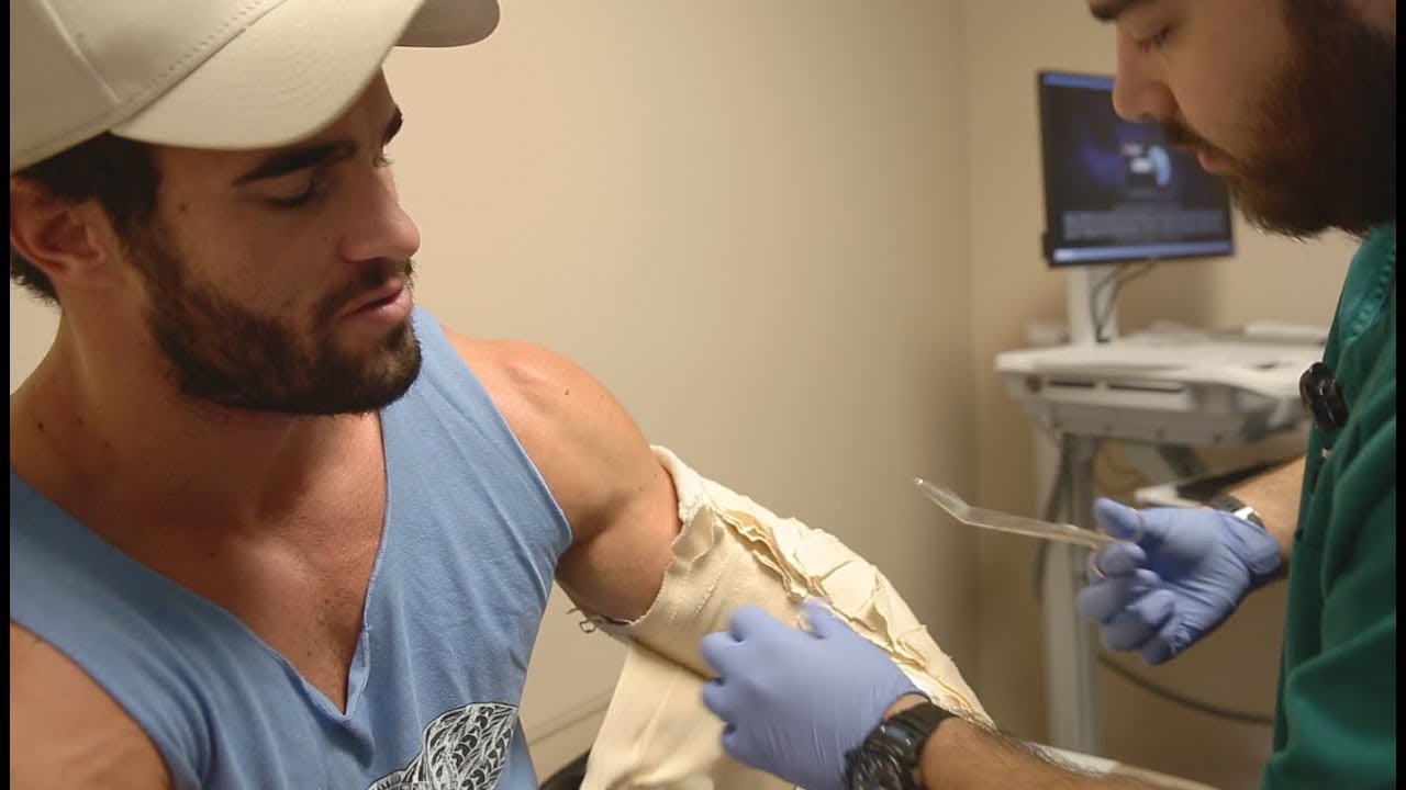 REMOVING THE CAST, I NEARLY FAINTED