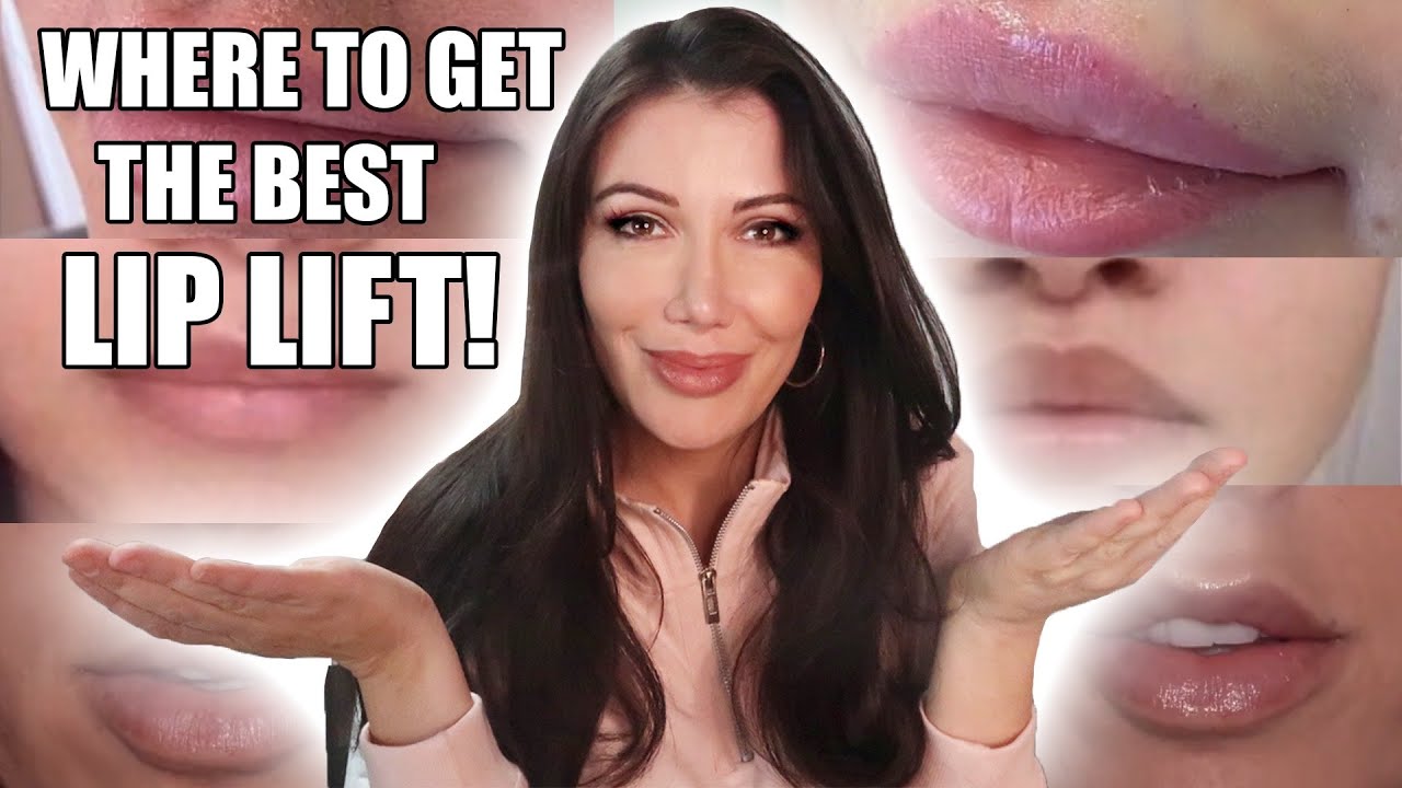 How to Find a Lip Lift Doctor