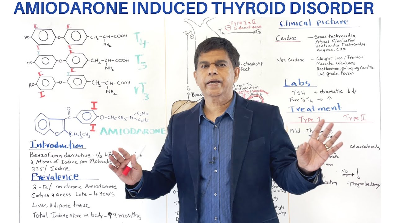 AMIODARONE INDUCED THYROID DISORDERS - AN OVERVIEW - By Pramil Cheriyath MD