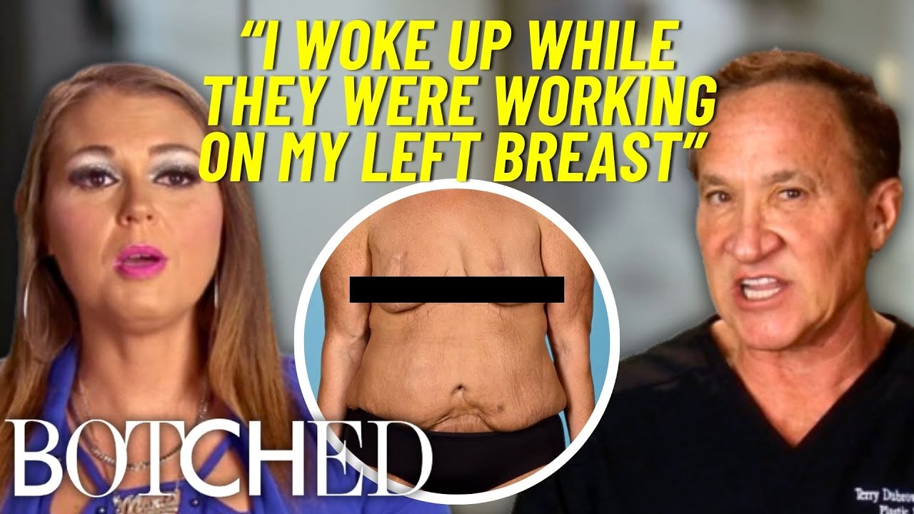 Mary Developed Necrosis & Lost BOTH Nipples After Botched Mommy Makeover in Mexico | Botched | E!