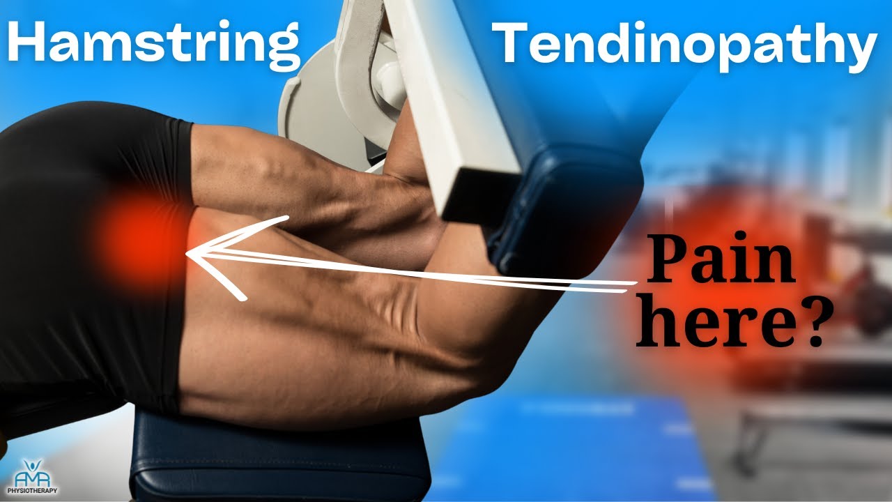 Proximal Hamstring Tendon Rehab: Progression Exercises for Buttock Pain!