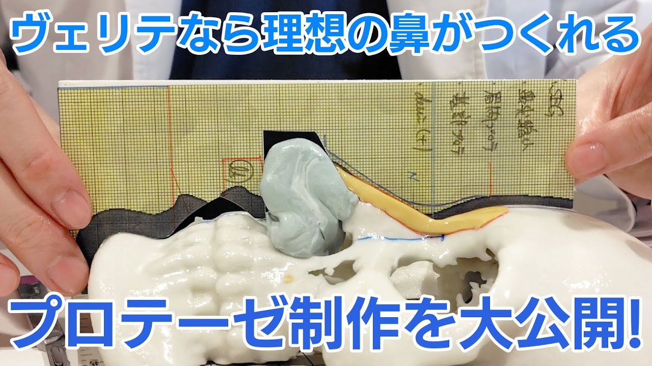 計画通りに鼻をつくる技術を大公開｜ヴェリテクリニック