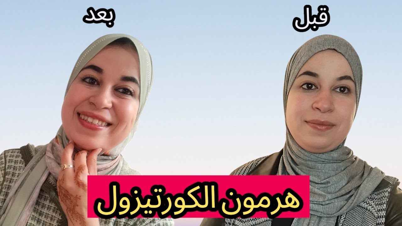 تغيرت بشرتي 180درجة بعد اكتشاف هرمون الكورتيزول  مهم لكل امراة