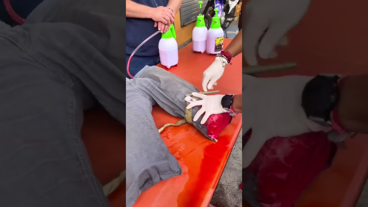 Using the tourniquet in STOP THE BLEED