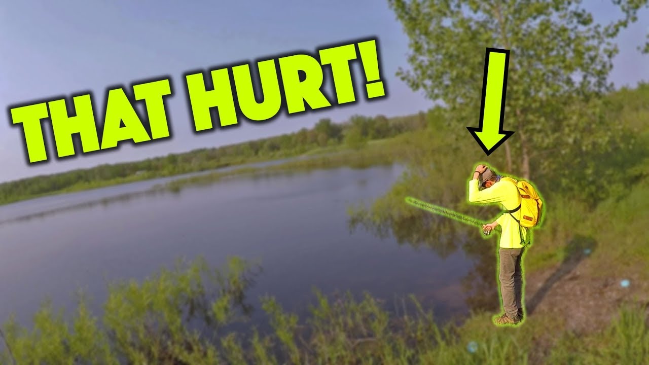 I HOOKED MYSELF In The Head!!