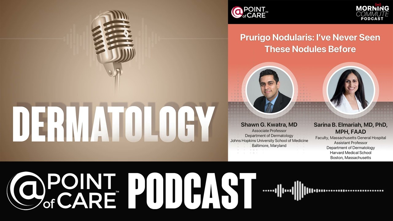 Ep1 : Prurigo Nodularis: I’ve Never Seen These Nodules Before
