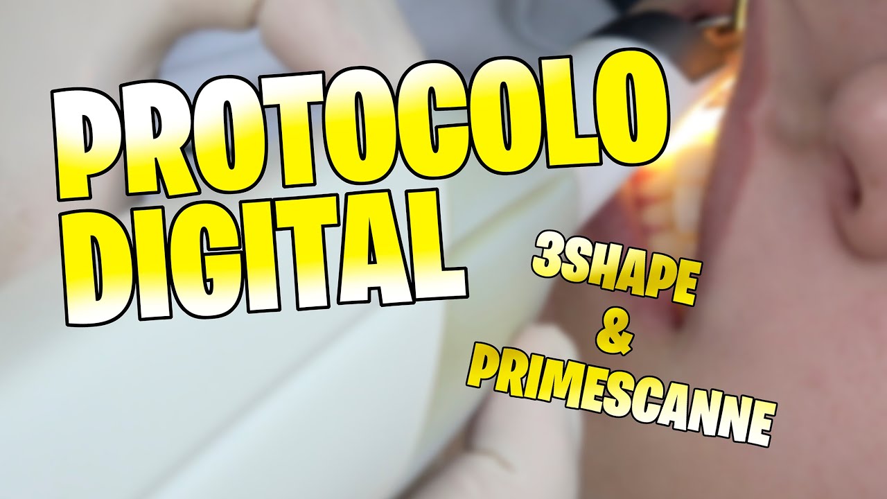 PrimeScanne vs Trios 3 - Scanner Intraoral