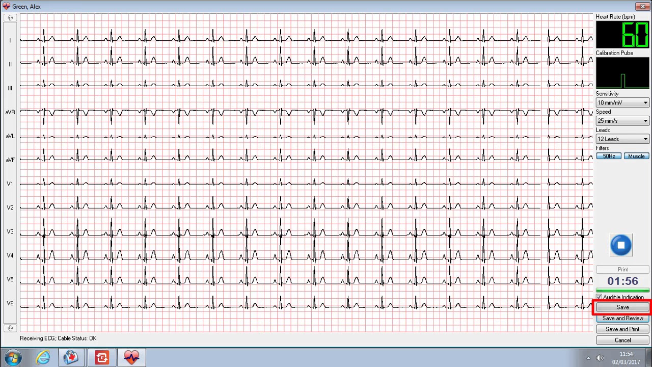 I3 Socrates   Universal ECG Training Video