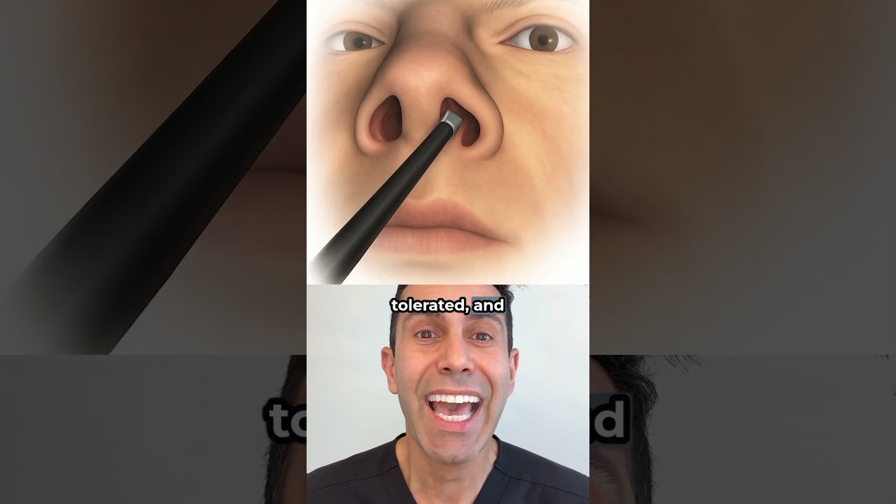 Radiofrequency Nasal Airway Remodeling with Dr. Zaghi | The Breathe Institute