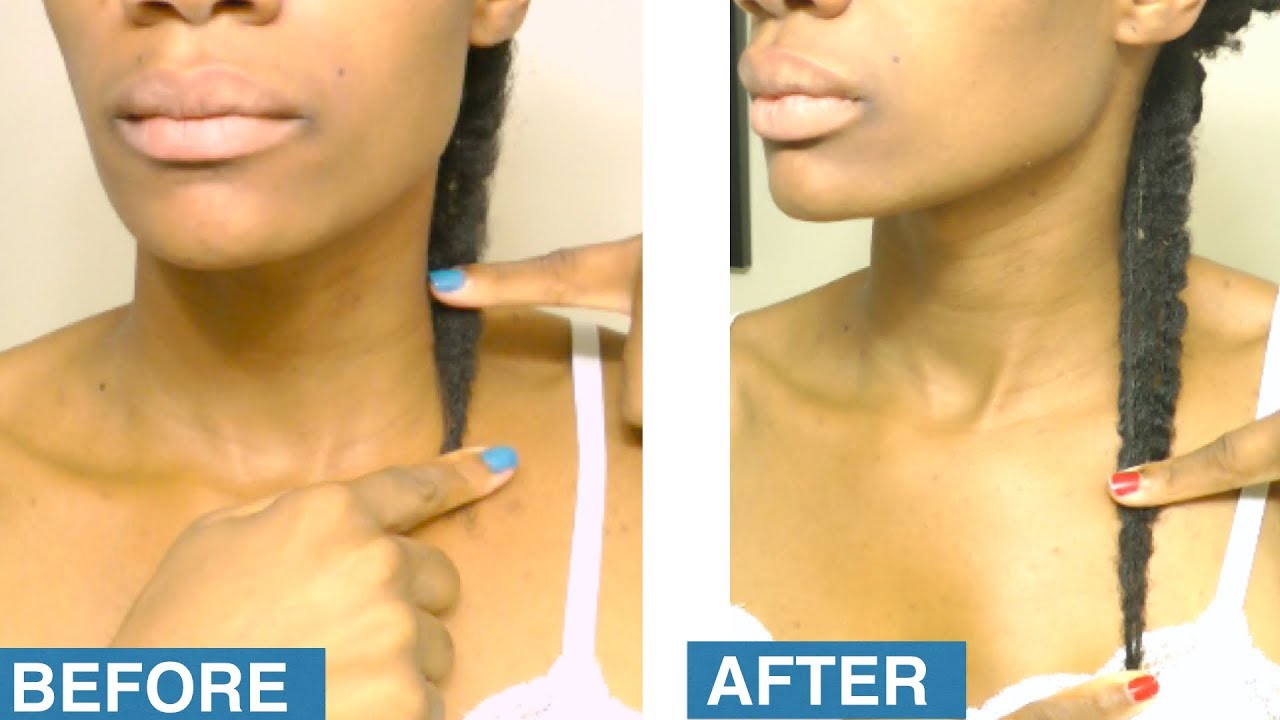I Grew My 4C Hair Faster - This is How (2017)