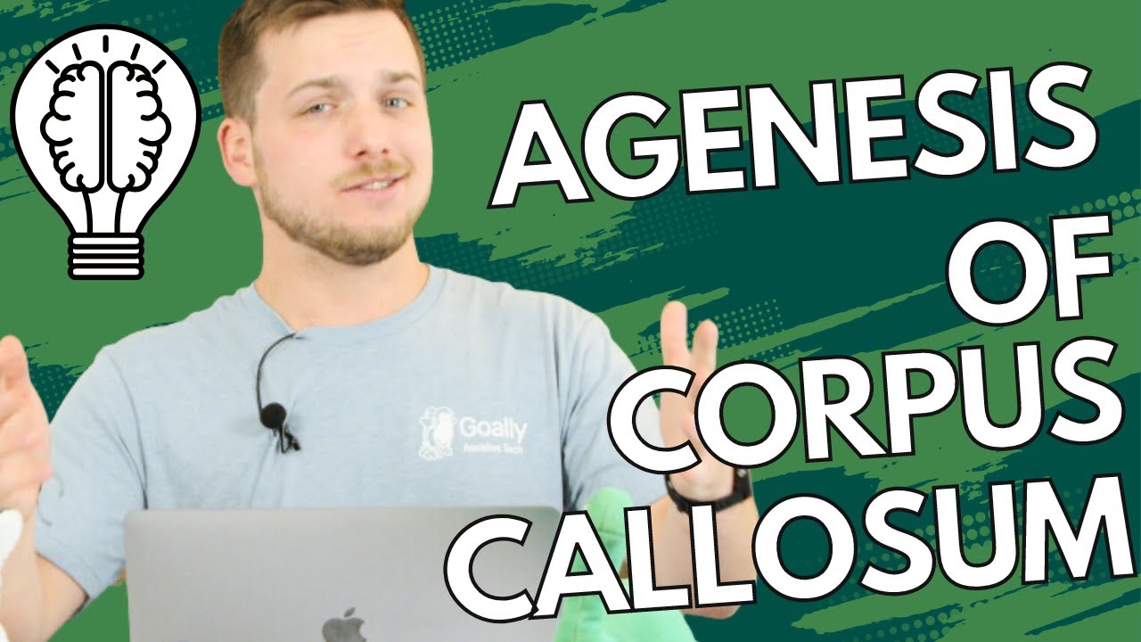 Agenesis of Corpus Callosum, brain disorder explained simply!