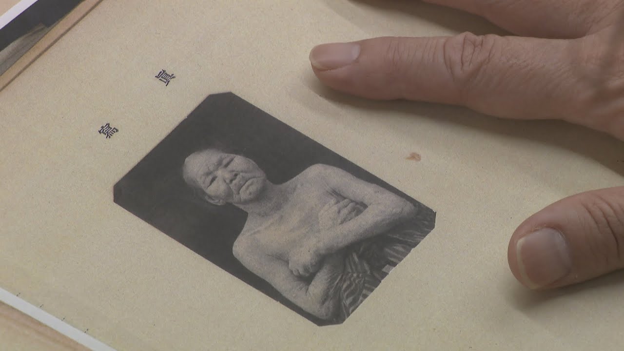 【特集】ハンセン病療養所入所者の遺族が知る「生きた証」　長島愛生園が記録を開示　岡山