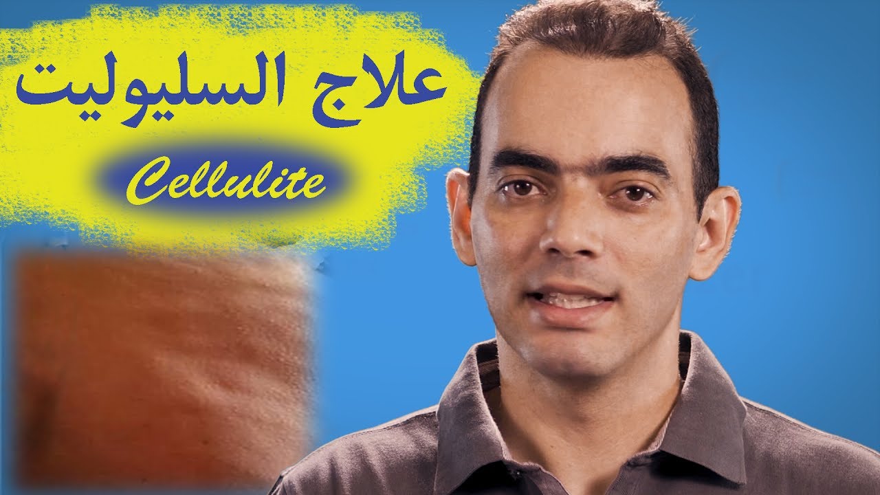علاج السليوليت cellulite - د. محمد الناظر