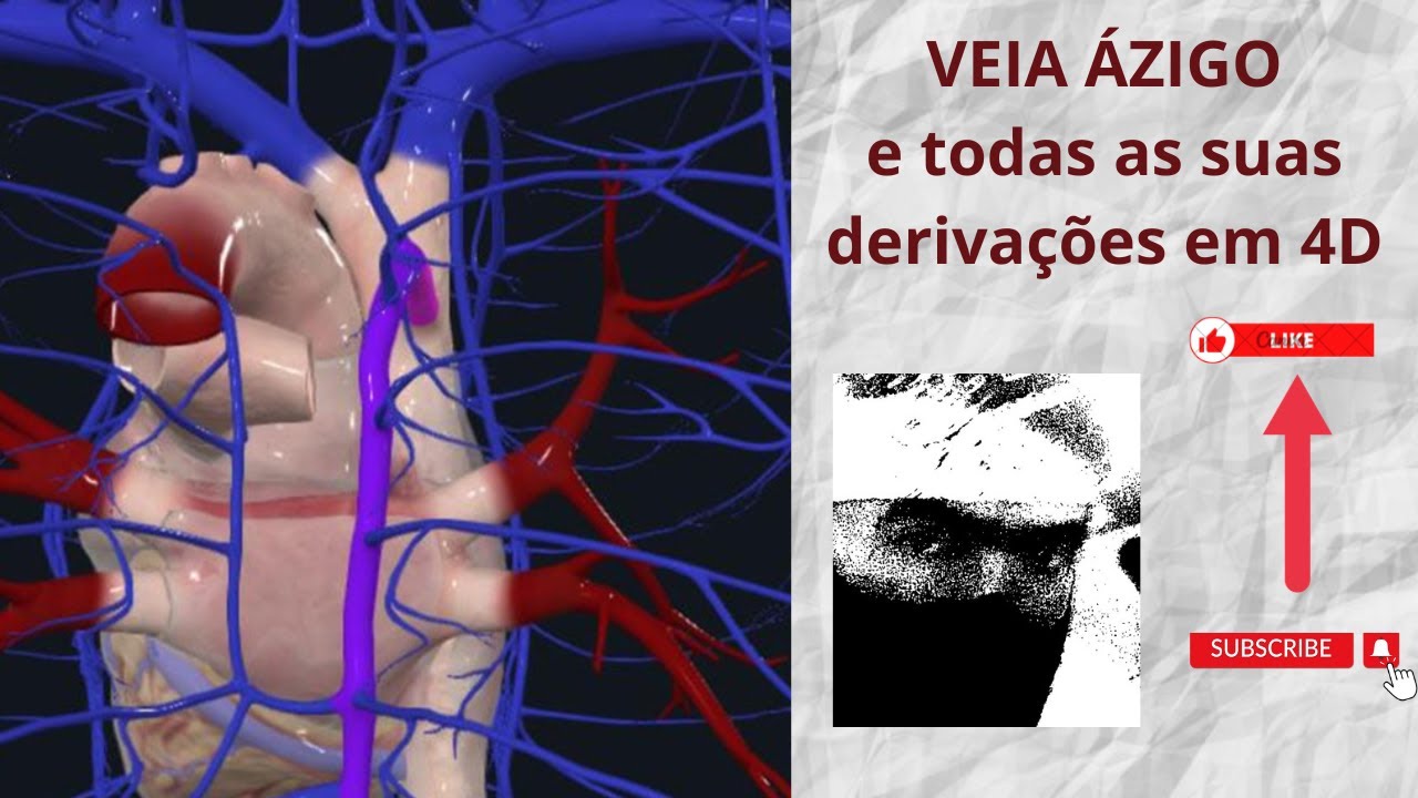 Veia ázigo e todas derivações em 4D