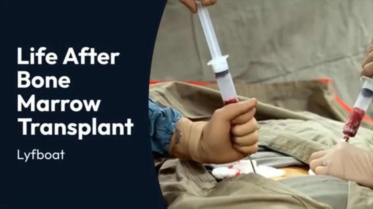 Life After Bone Marrow Transplant Surgery  | Recovery, Aftercare, Lifestyle