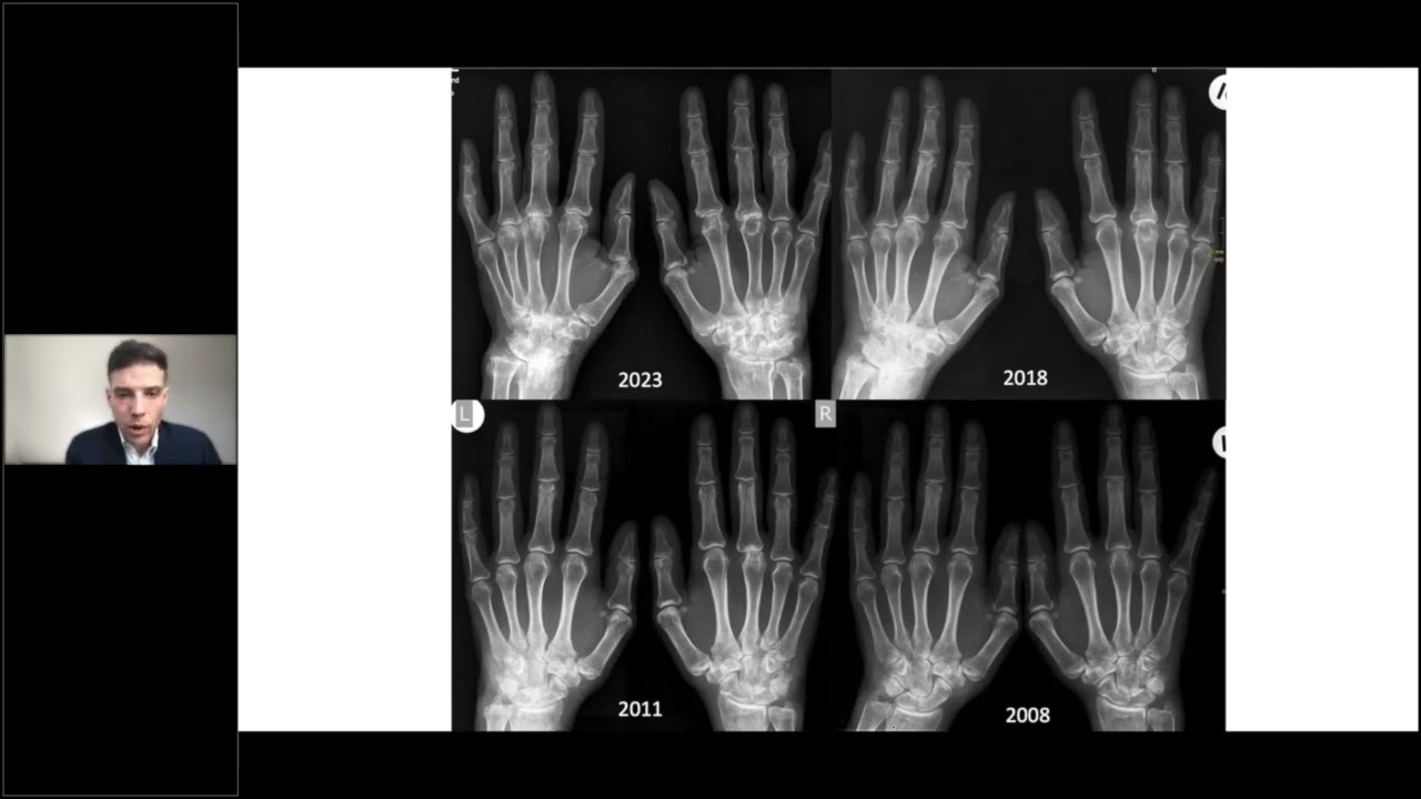 Fallpräsentation aus dem Alltag 1 – Dr. med. Mathias Ausserwinkler, MSc