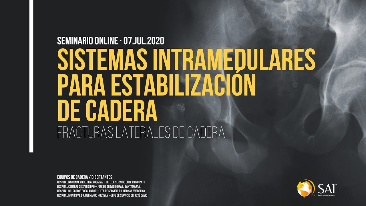 Clavos intramedulares para Estabilización de Cadera | Seminario online South America Implants