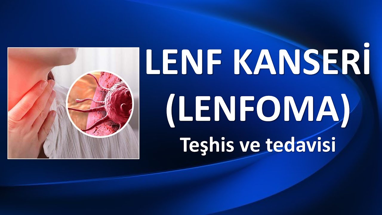 LENFOMA NEDİR? Lenfoma Teşhis ve Tedavisi