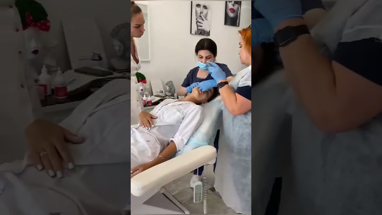 Injectable PLLA Dermal Filler