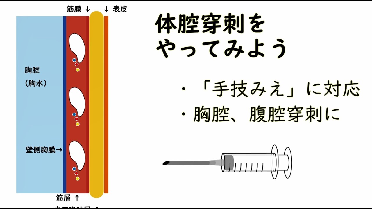 体腔穿刺④：実際の穿刺手技解説（胸腔穿刺・腹腔穿刺）