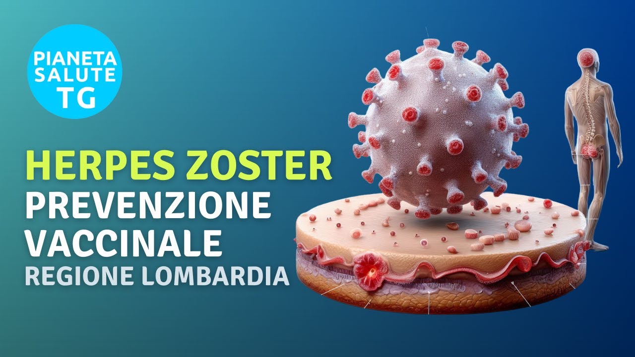 Prevenzione vaccinale contro Herpes Zoster: i numeri di una scelta di salute