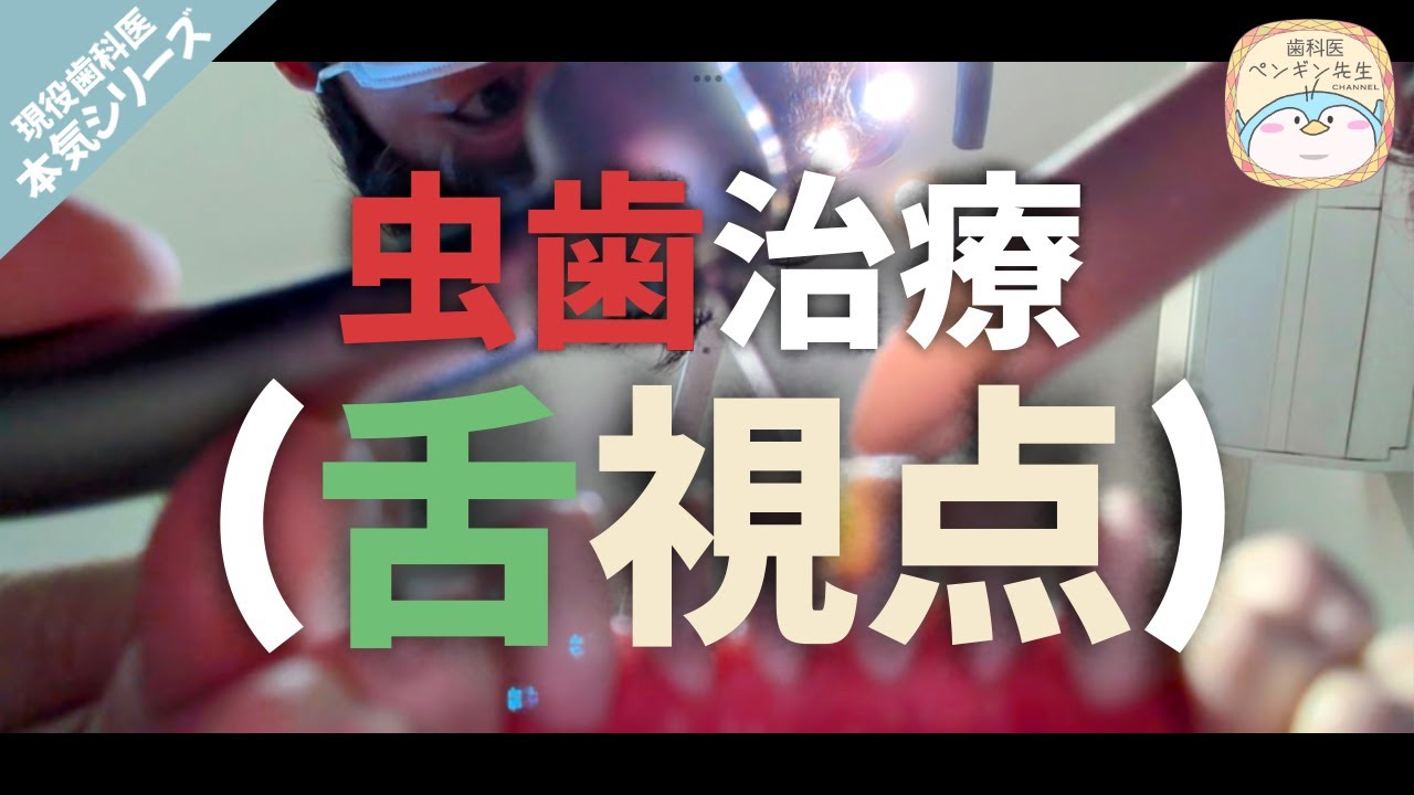 【ASMR】本物の歯医者が虫歯治療ロールプレイ【詰め物 バイノーラル dentist dental tooth】音質重視