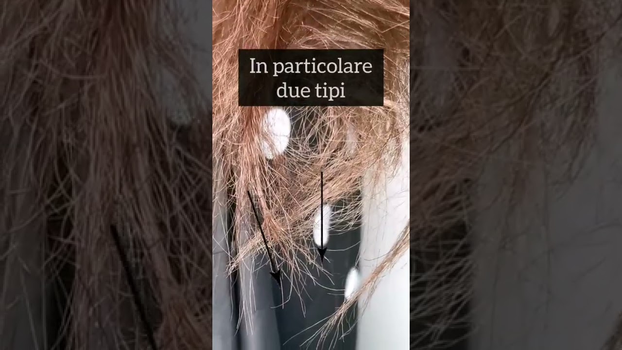 Come sono le doppie punte?
