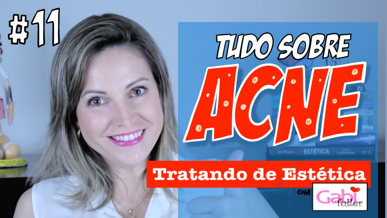 Tudo sobre Acne - Aula Teórica