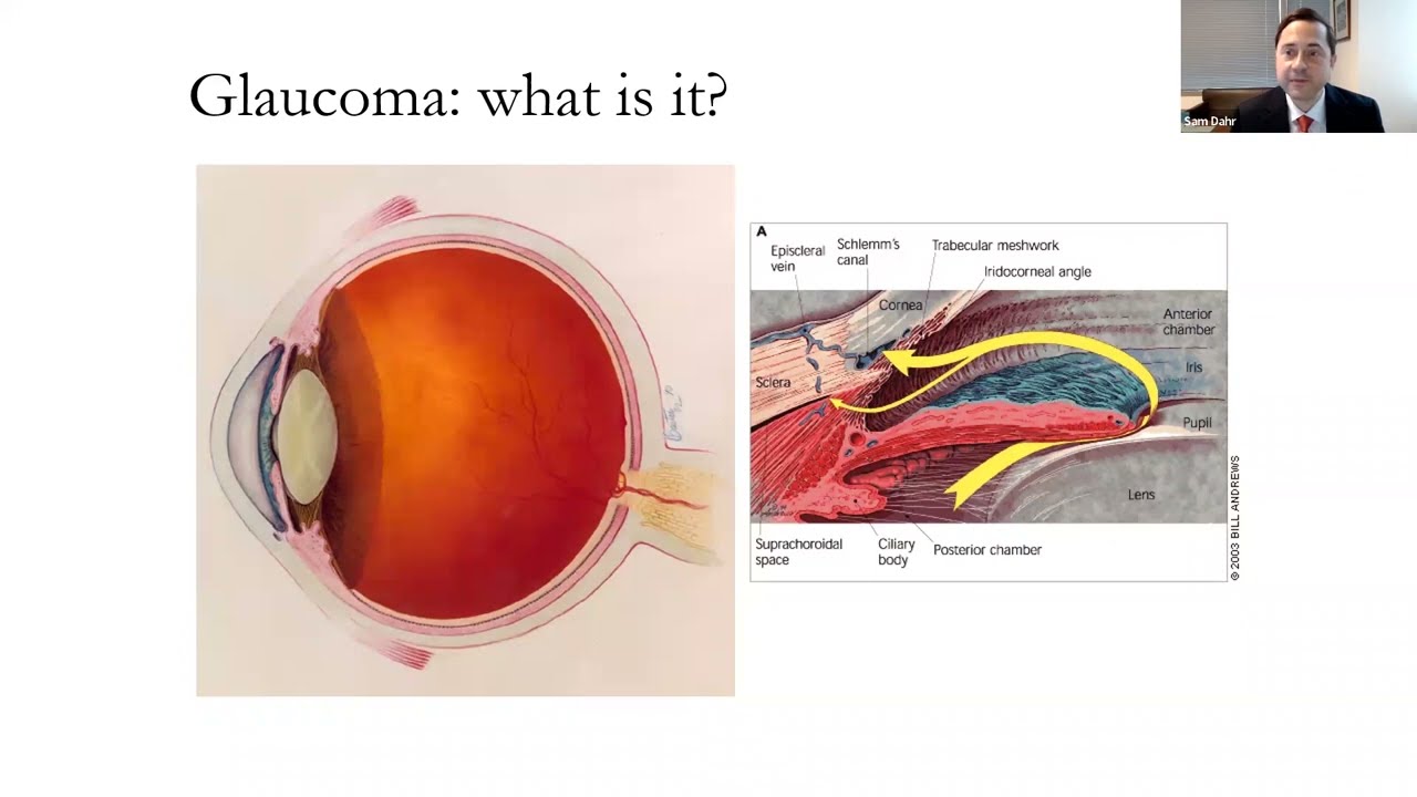Age-related eye disease with Sam Dahr, MD, MS