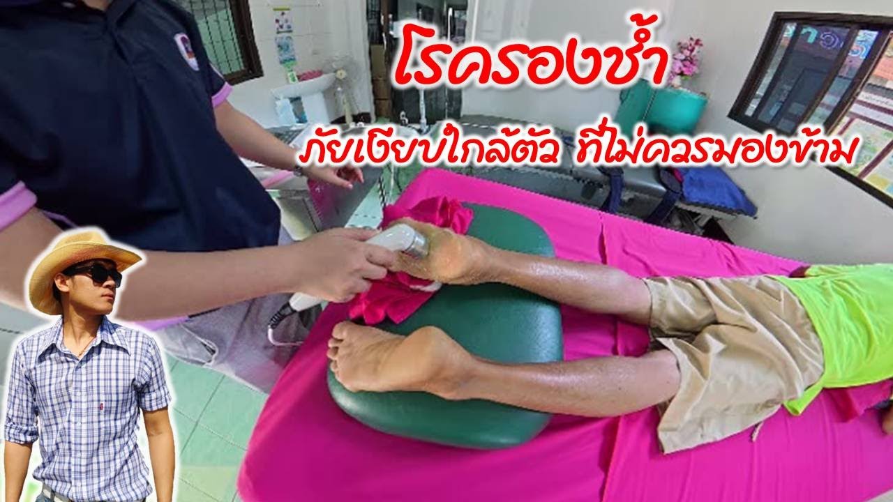 โรครองช้ำ ภัยใกล้ตัวที่ไม่ควรมองข้าม