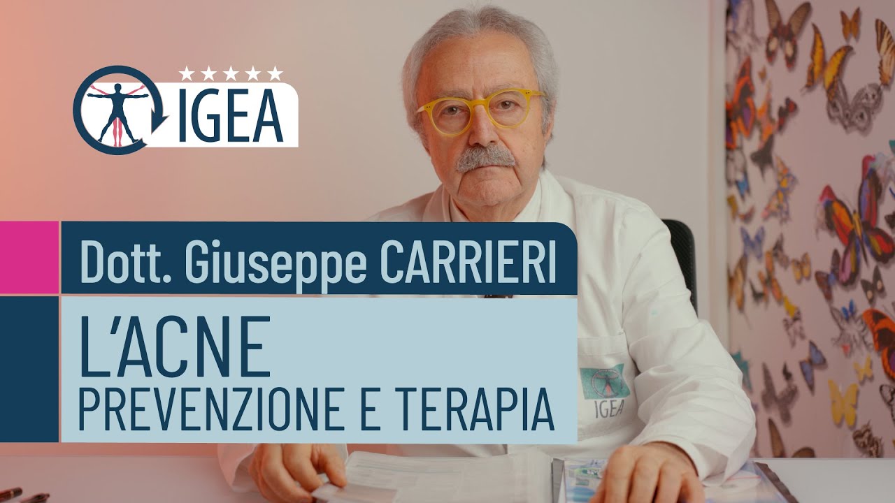 L'ACNE: a cura del Dermatologo Dott. Giuseppe Carrieri