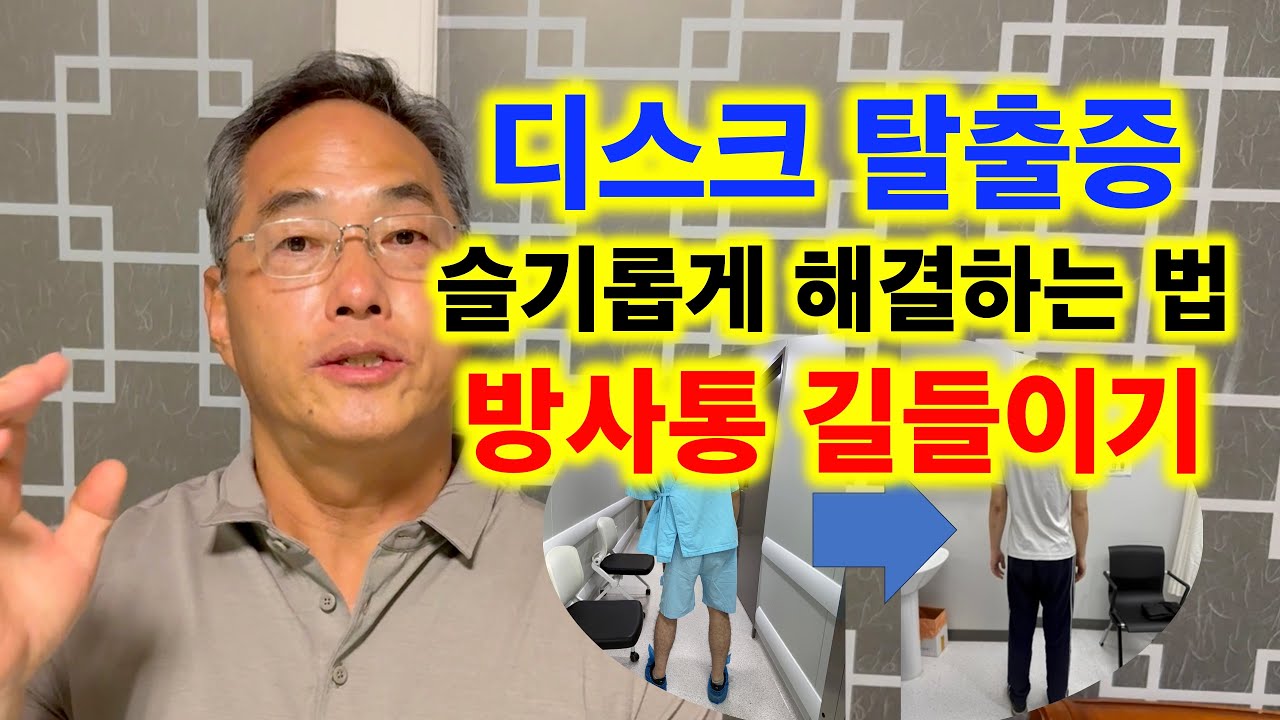 디스크 탈출증 슬기롭게 해결하는 법: 방사통 길들이기