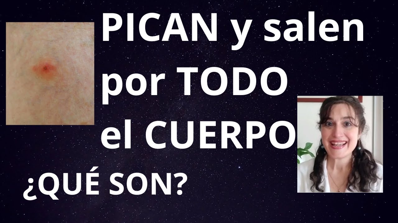 Me salen 
