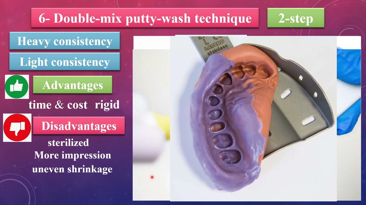 6- Double-Mix Putty-Wash Impression Technique 2-Step