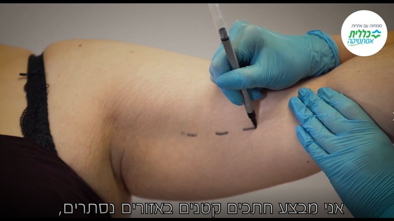 ניתוח שאיבת שומן בכללית אסתטיקה