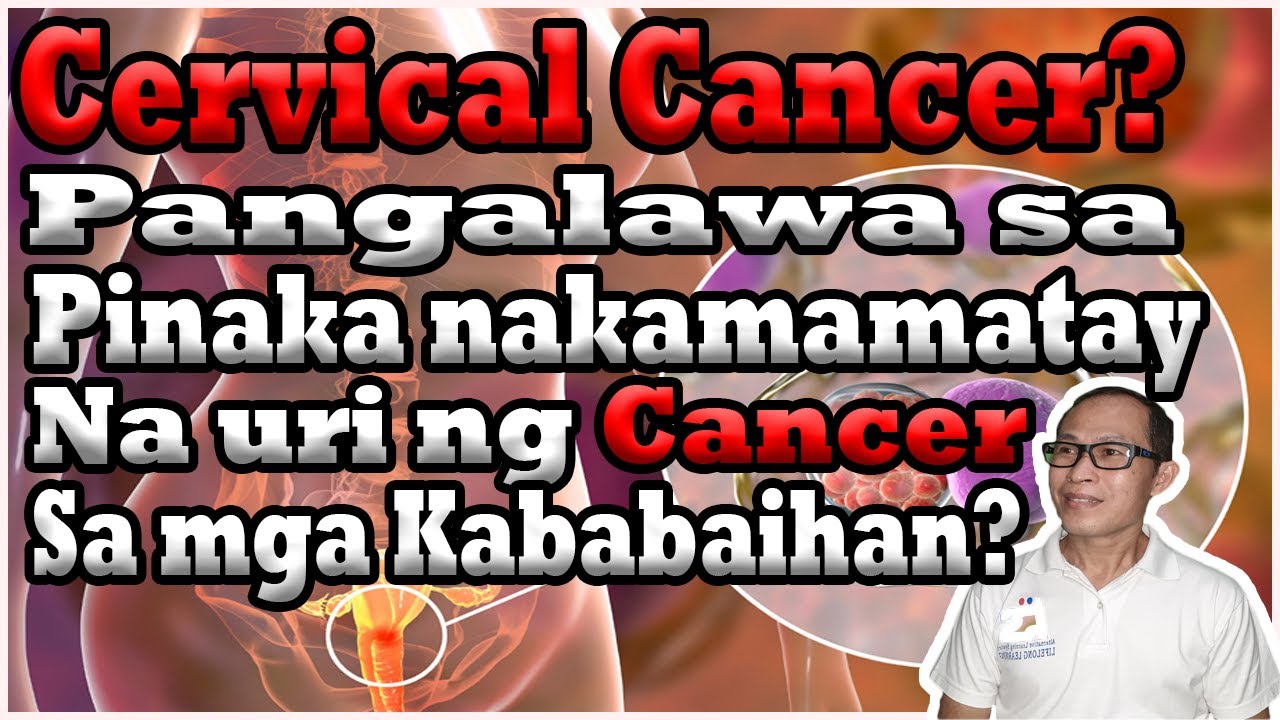 Cervical Cancer ang pangalawa sa pinaka nakamamatay na uri ng Cancer sa mga Kababaihan?