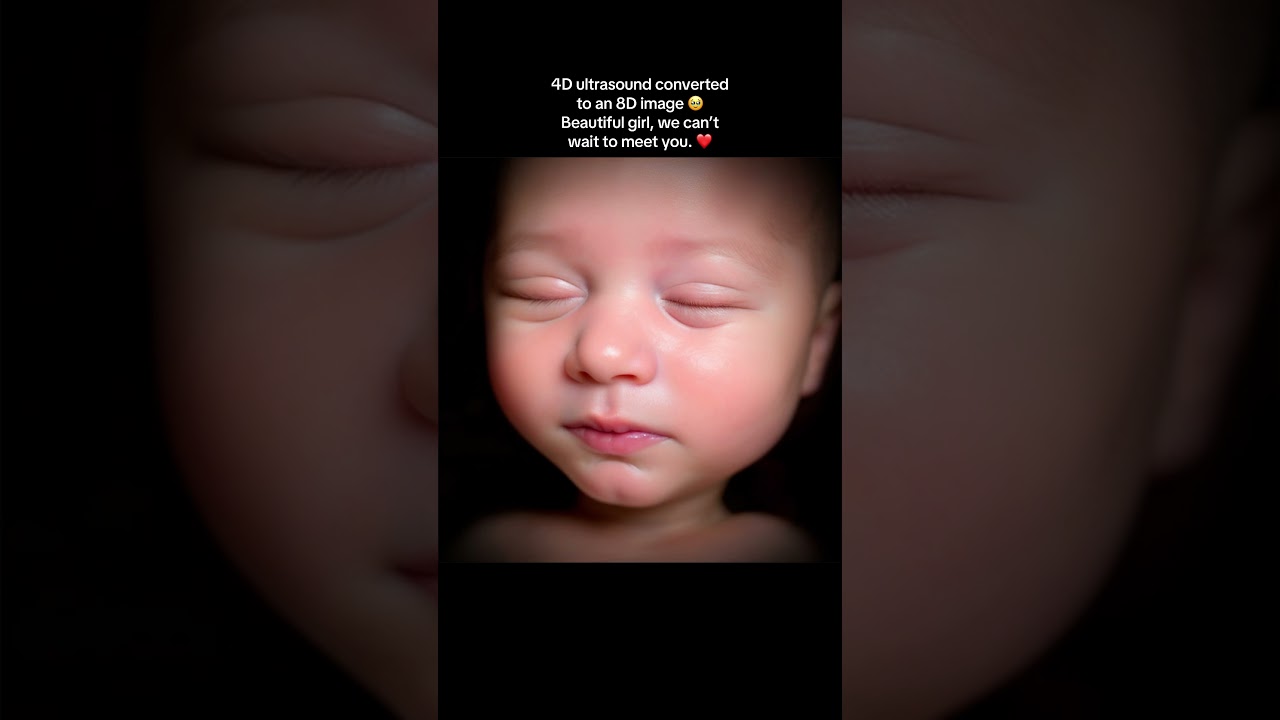 4D ultrasound converted to 8D image 🥰 I can’t believe how far technology has come. #ultrasound