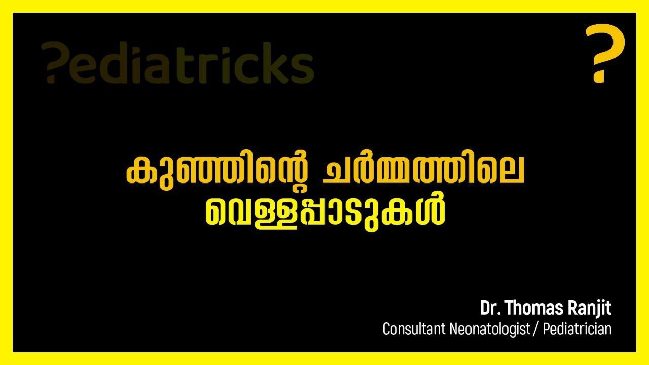 കുഞ്ഞിന്‍റെ ചര്‍മ്മത്തിലെ വെള്ളപ്പാടുകള്‍