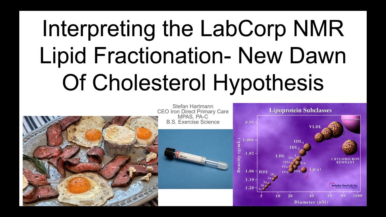 Interpreting LabCorp NMR LipoProfile - New Dawn of The Cholesterol Hypothesis