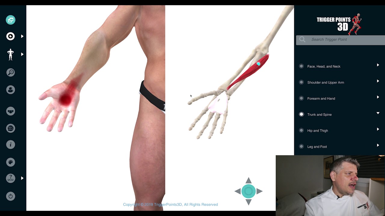 Palmaris Longus - Trigger Point of the Week