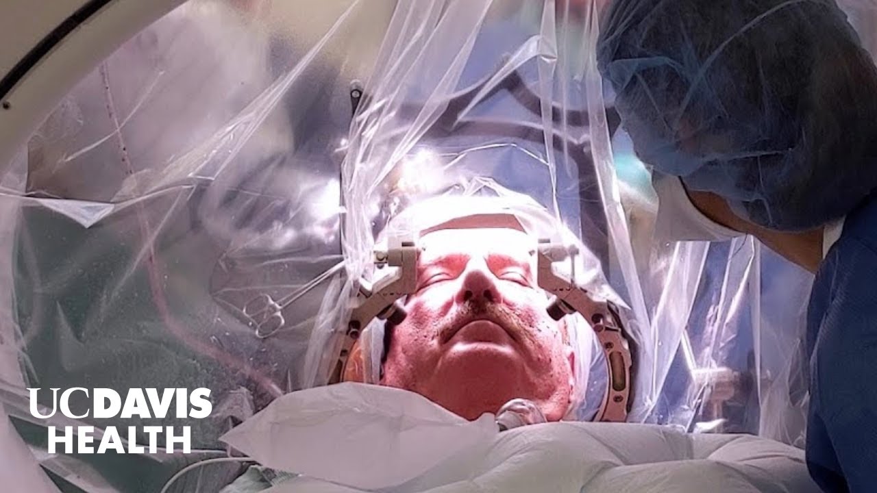 Robotic Neurosurgery at UC Davis Health &mdash; The First Comprehensive Program in the Region