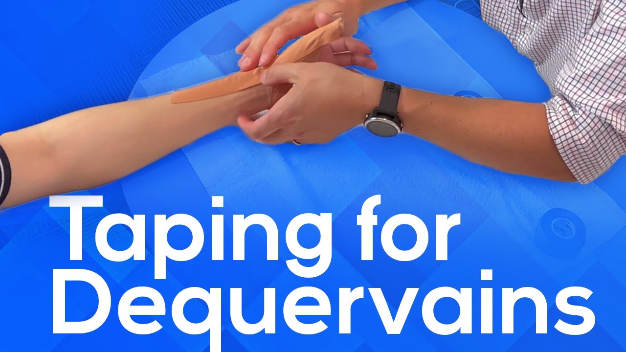 DeQuervains Tenosynovitis Taping Technique