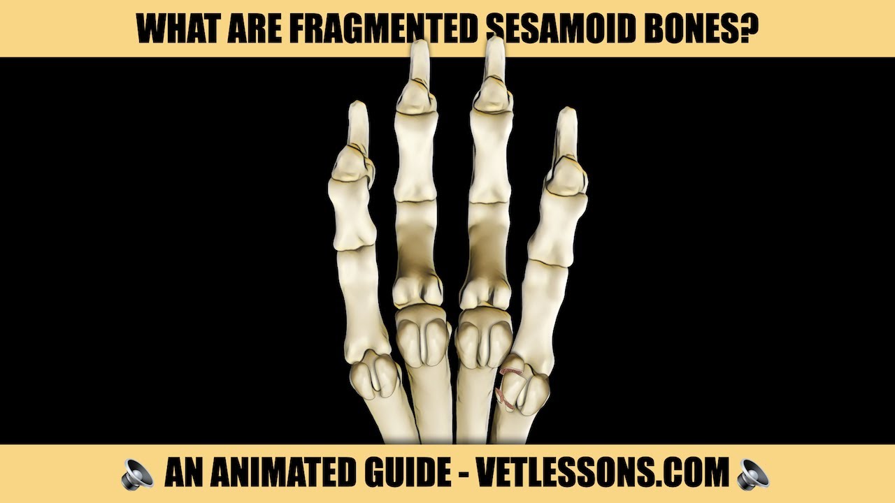 WHAT ARE FRAGMENTED SESAMOID BONES?