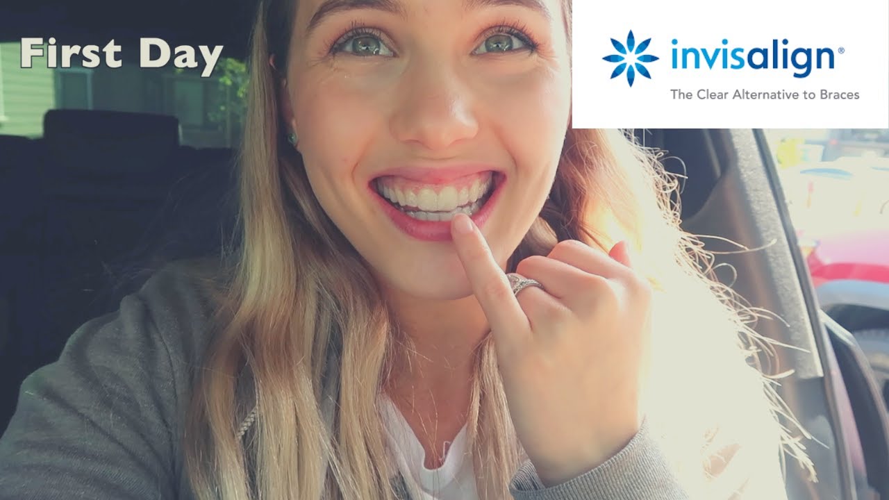 I Got Invisalign and I Regret It + Easter Footage
