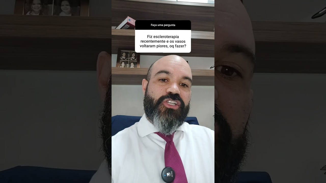 😭 Fiz APLICA&Ccedil;&Atilde;O de Varizes e parece que PIOROU TUDO!! O que FAZER?? #vidasemvarizes