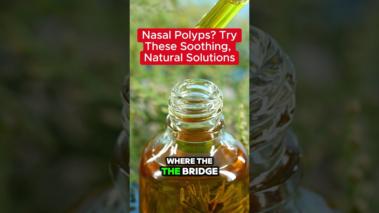 🍃Nasal Polyps? Try These Soothing Natural Solutions🍃