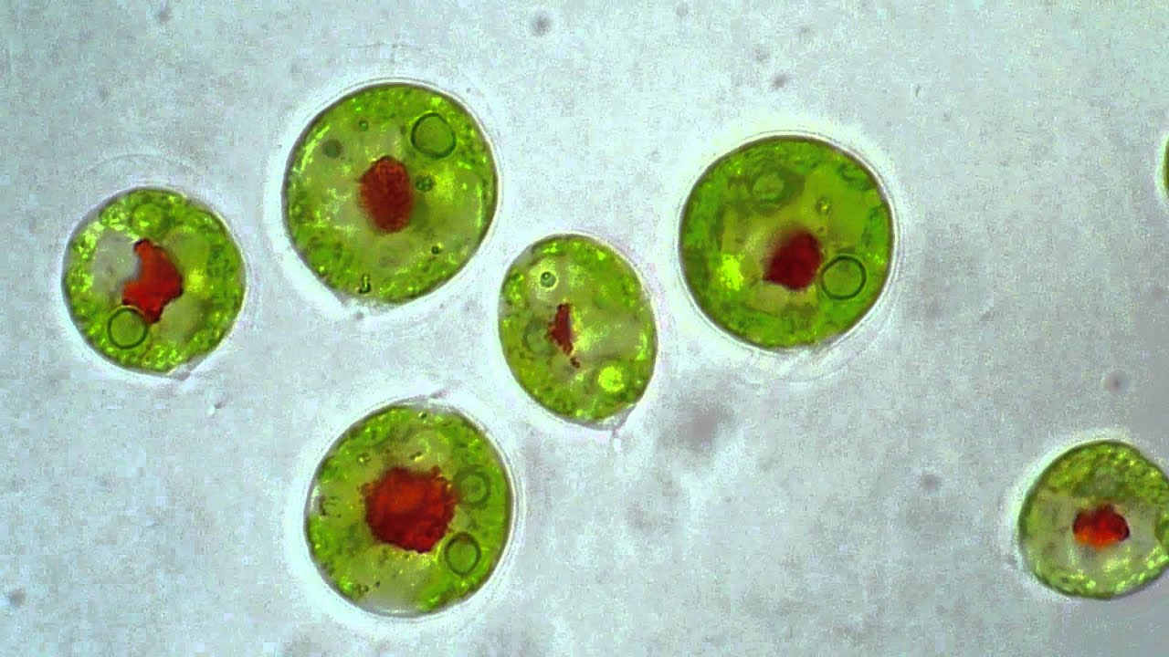 Haematococcus in Brightfield