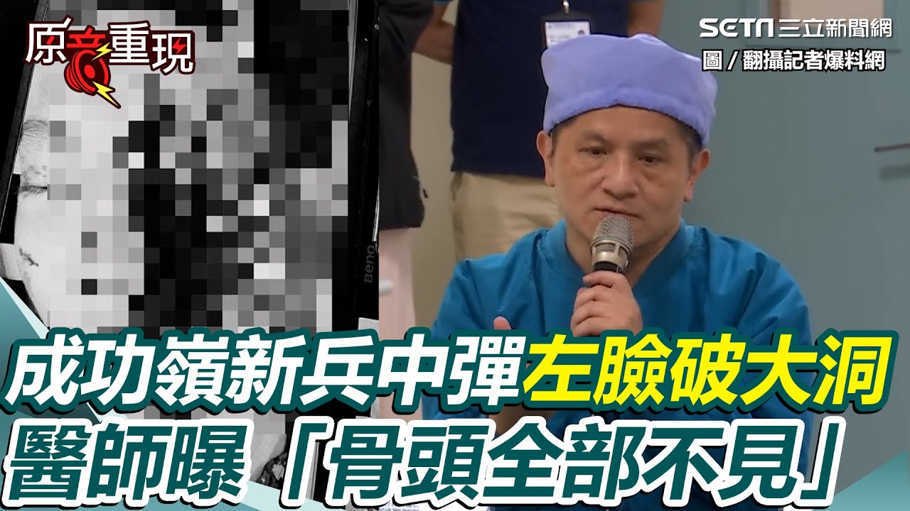 【#原音重現】驚悚畫面曝！成功嶺新兵打靶中彈左臉破大洞...醫師曝送醫後面部景象 嘴到顱底「骨頭全部不見」：整個是可以看得到｜三立新聞網 SETN.com